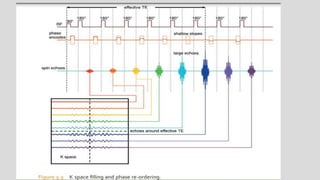 Mri spin echo pulse sequences its variations and | PPTX