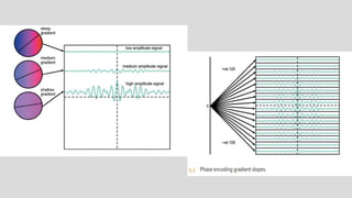 Mri spin echo pulse sequences its variations and | PPTX