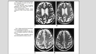 Mri spin echo pulse sequences its variations and | PPTX