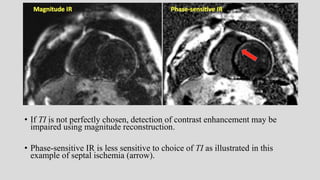 Mri spin echo pulse sequences its variations and | PPTX