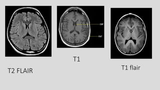 Mri spin echo pulse sequences its variations and | PPTX