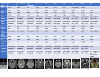 MRI tabel Ria.docx