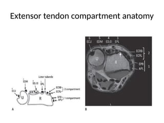 its a brief description of how to interpret mri findings of a wrist.it ...