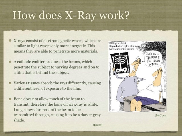 mri and x ray of the neonate spine xray works