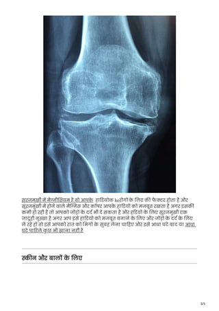 3/5
सूरजमुखी म मै ी शयम है वो आपक
े हा डयोक keरोग क
े लए क फ
ै र होता है और
सूरजमुखी म होने वाले मै स और कॉपर आपक
े हा डयो को मजबूत रखता है अगर इसक
कमी हो रही है तो आपको जोड़ो क
े दद भी दे सकता है और ह डयो क
े लए सूरजमुखी एक
जादूही नु ा है अगर आप इसे हा डयो को मजबूत बनाने क
े लए और जोड़ो क
े दद क
े लए
ले रहे हो तो इसे आपको रात को भगो क
े सुबह लेना चा हए और इसे आधा घटे बाद या आधा
घटे पा हले क
ु छ भी खाना नही है
न और बाल क
े लए
 