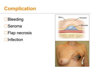 Complication
Bleeding
Seroma
Flap necrosis
Infection
 