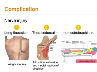 Complication
Nerve injury
Long thoracic n. Thoracodorsal n. Intercostrobrachial n.
1 2 3
Adduction, extension
and medial rotation of
shoulder
Wing’s scapula
Intercostrobrachial n.
 