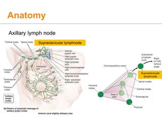 Anatomy
Axillary lymph node
Supraclavicular lymphnode
Supraclavicular
lymphnode
 