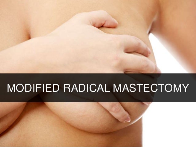 MODIFIED RADICAL MASTECTOMY
 