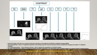 MR MAMMOGRAPHY shdjsjsjdjsjdjdhdhdhdhdhs | PPTX