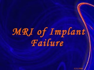 MRI of Implant Failure 