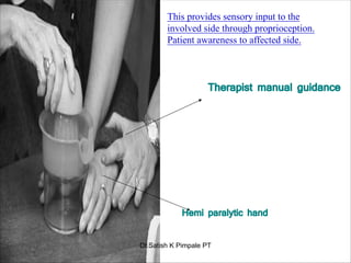 Hemi paralytic hand
Therapist manual guidance
This provides sensory input to the
involved side through proprioception.
Patient awareness to affected side.
Dr.Satish K Pimpale PT
 