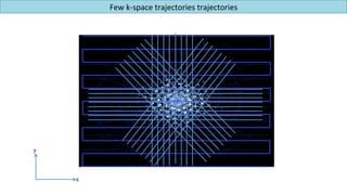 20 40 60 80 100 120
50
100
150
200
250
Few	k-space	trajectories	trajectories		
y
x
 