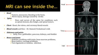 ¡  Head	
¡ 	Tumors,	aneurysms,	bleeding	in	the	brain,		
¡ 		Nerve	injury,	damage	caused	by		stroke.		
¡  	Spine	
¡  Discs	 and	 nerves	 of	 the	 spine	 for	 conditions	 such	
as	spinal	stenosis,	disc	bulges,	and	spinal	tumors.	
¡  Chest	:	Heart,	the	valves,	and	coronary	blood	vessels	
¡  Blood	vessels	and	?low	–	Dr.	Ramesh	Venkatesan’s	talk			
¡  Abdomen	and	pelvis	
¡  Belly,	liver,	gallbladder,	pancreas,	kidneys,	and	bladder	
¡  Bones	and	joints	
¡ 	Arthritis,	problems	with	joints	,bone	marrow	problems,	
¡ 	Bone	tumors,	cartilage	problems,		
¡ 	Torn	ligaments	or	tendons,		infection.	
 