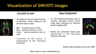 COLOUR FA MAP TRACTOGRAPHY
•  According to the principal direction
of diffusion, colour coding of the
diffusion data is done
•  Red - transverse axis (x-axis)
•  Blue – superior-inferior (z –axis)
•  Green – anterior-posterior axis (y-
axis)
•  Intensity of the colour is
proportional to the fractional
anisotropy
•  It is 3D modeling technique used to
visually represent neural tracts
using data collected by diffusion
tensor imaging (DTI)
•  Voxels are connected based upon
similarities in the maximum
diffusion direction.
Figure Source: www.radiopaedia.org
Matlab Code available with Arush, MIRC
 