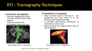Figure source: Nucifora et al. Radiology 245:2 (2007)
Corticospinal Tracts -ProbabilisticCorticospinal Tracts - Streamline
1.Streamline tractography
•  Connects neighbouring voxels
from user defined voxels (seed
regions)
•  Tracts are traced until
termination criteria are met.
2.Probabilistic tractography
•  Value of each voxel in the map is the
probability the voxel which is in the
diffusion path between the ROIs.
•  It provides quantitative probability of
connection at each voxel
•  Allows tracking into regions where there is
low anisotropy.
 