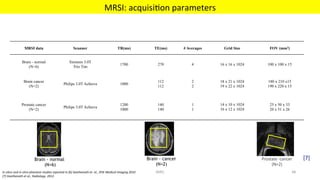 Brain - normal
(N=6)
Brain - cancer
(N=2)
Prostate -cancer
(N=2)
MRSI data Scanner TR(ms) TE(ms) # Averages Grid Size FOV (mm3)
Brain - normal
(N=6)
Siemens 3.0T
Trio Tim
1700 270 4 16 x 16 x 1024 100 x 100 x 15
Brain cancer
(N=2)
Philips 3.0T Achieva 1000
112
112
2
2
18 x 21 x 1024
19 x 22 x 1024
180 x 210 x15
190 x 220 x 15
Prostate cancer
(N=2)
Philips 3.0T Achieva
1200
1000
140
140
1
1
14 x 10 x 1024
16 x 12 x 1024
25 x 50 x 33
20 x 51 x 26
In	silico	and	in	vitro	phantom	studies	reported	in	[6]	Geethanath	et.	al.,	SPIE	Medical	Imaging	2010	
[7]	Geethanath	et	al.,	Radiology.	2012	
MRSI:	acquisi'on	parameters	
MIRC	 48	
[7]		
 