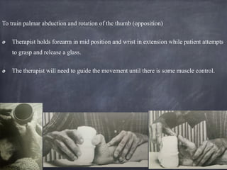 To train palmar abduction and rotation of the thumb (opposition)
Therapist holds forearm in mid position and wrist in extension while patient attempts
to grasp and release a glass.
The therapist will need to guide the movement until there is some muscle control.
 