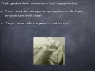 To train opposition of radial and ulnar sides of hand (cupping of the hand)
Forearm in supination, patient practices opposing thumb and other fingers,
particularly fourth and fifth fingers.
Therapist demonstrated how the palm of the hand should cup.
 