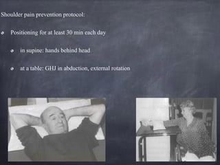 Shoulder pain prevention protocol:
Positioning for at least 30 min each day
in supine: hands behind head
at a table: GHJ in abduction, external rotation
 