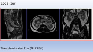 Mr procedure of pelvis and hip joint | PPTX