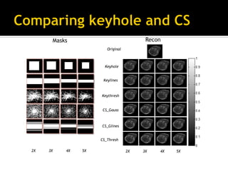 Key Hole Mask MR reconstruction 101 | PDF