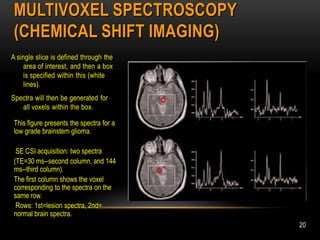 MR Spectroscopy | PDF