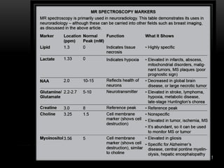 MR Spectroscopy | PDF