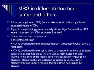 Mrs. Brain Example MRS | PPT
