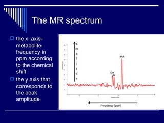 MRS | PPT