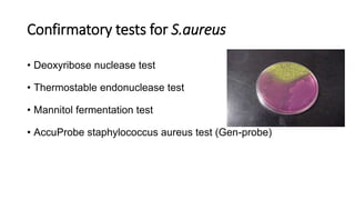 Confirmatory tests for S.aureus
• Deoxyribose nuclease test
• Thermostable endonuclease test
• Mannitol fermentation test
• AccuProbe staphylococcus aureus test (Gen-probe)
 