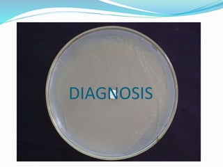 DIAGNOSIS 
 