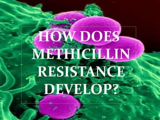 HOW DOES 
METHICILLIN 
RESISTANCE 
DEVELOP? 
 