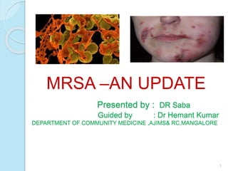Presented by : DR Saba
Guided by : Dr Hemant Kumar
DEPARTMENT OF COMMUNITY MEDICINE ,AJIMS& RC,MANGALORE
1
MRSA –AN UPDATE
 