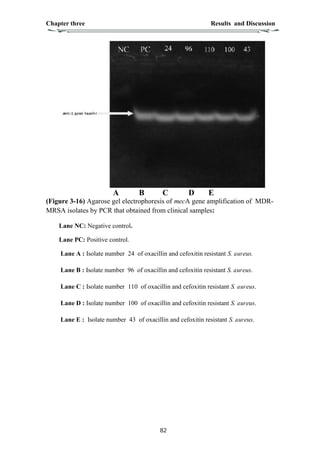 MRSA | PDF