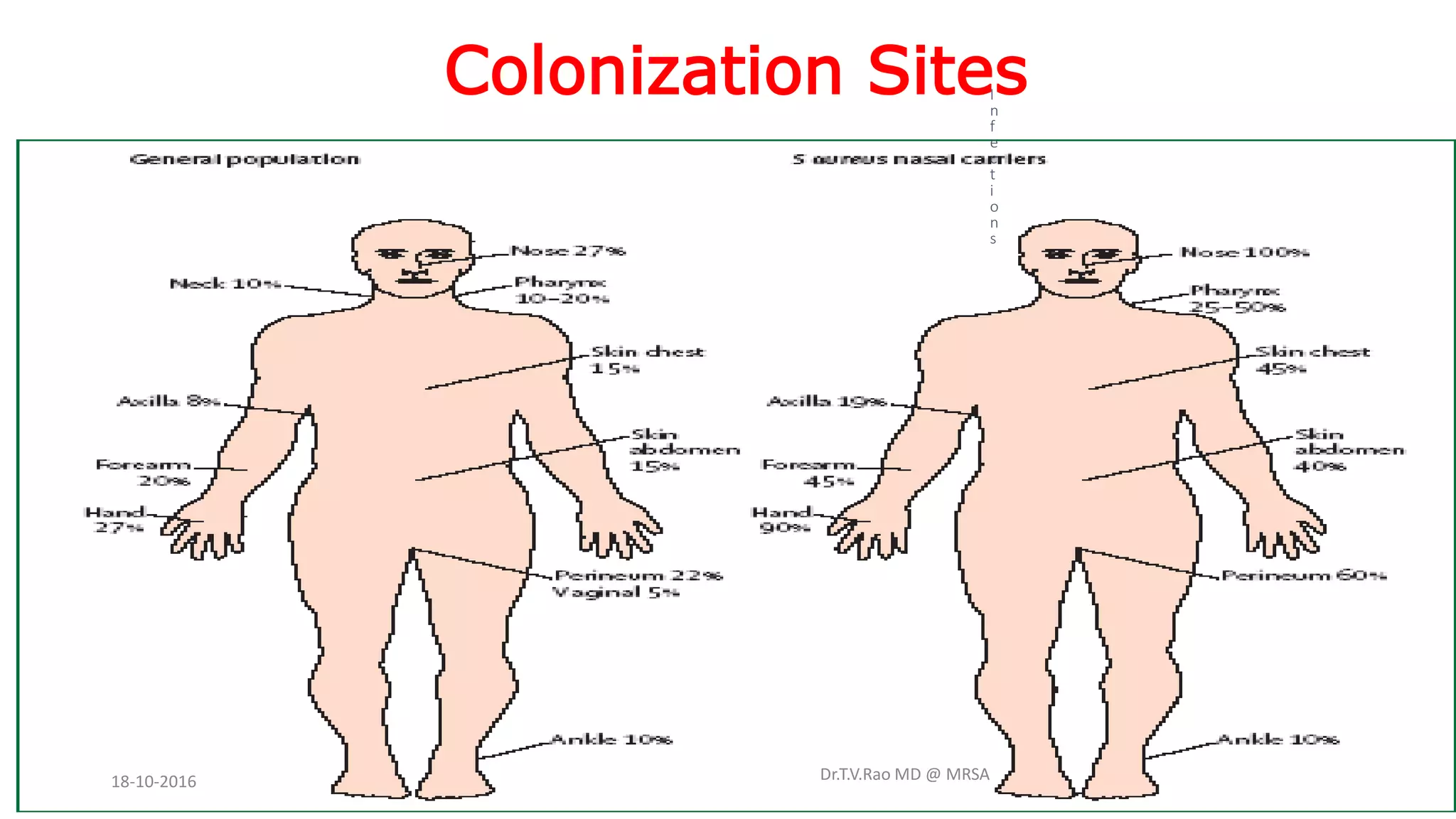 Colonization Sites
Dr.T.V.Rao MD @ MRSA
I
n
f
e
c
t
i
o
n
s
18-10-2016
 