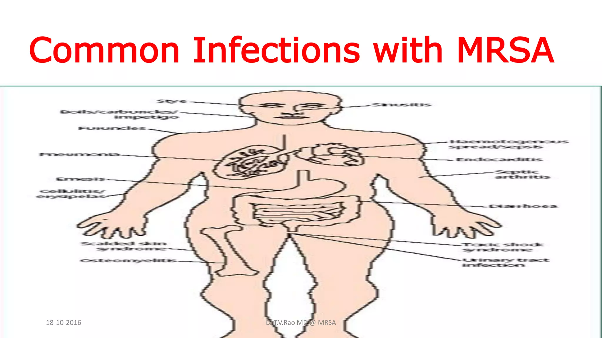 Common Infections with MRSA
18-10-2016 Dr.T.V.Rao MD @ MRSA
 