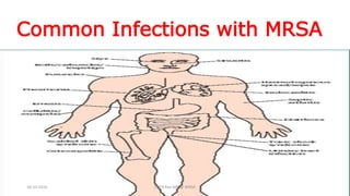 Common Infections with MRSA
18-10-2016 Dr.T.V.Rao MD @ MRSA
 