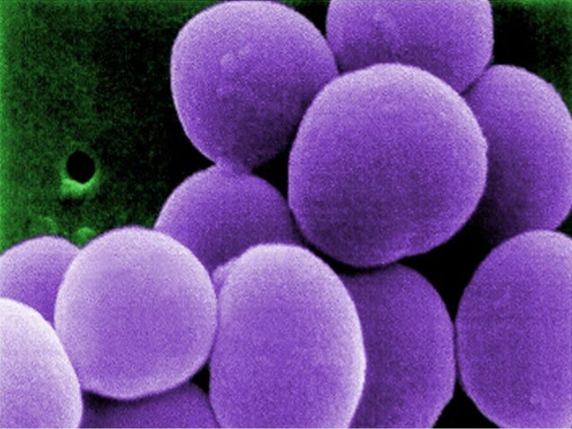 MRSA, Mrsa Antibiotics, Mrsa Staph, Mrsa Symptoms, Nasal Mrsa, What I…