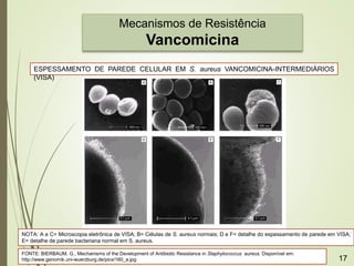 Mecanismos de Resistência
Vancomicina
NOTA: A e C= Microscopia eletrônica de VISA; B= Células de S. aureus normais; D e F= detalhe do espessamento de parede em VISA;
E= detalhe de parede bacteriana normal em S. aureus.
ESPESSAMENTO DE PAREDE CELULAR EM S. aureus VANCOMICINA-INTERMEDIÁRIOS
(VISA)
FONTE: BIERBAUM, G., Mechanisms of the Development of Antibiotic Resistance in Staphylococcus aureus. Disponível em:
http://www.genomik.uni-wuerzburg.de/pics/160_a.jpg 17
 