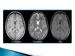 BASIC MRI SEQUENCES | PPTX