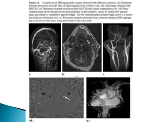 BASIC MRI SEQUENCES | PPTX
