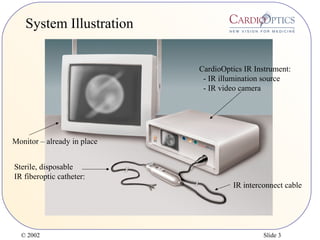 © 2002 Slide 3
System Illustration
Monitor – already in place
CardioOptics IR Instrument:
- IR illumination source
- IR video camera
IR interconnect cable
Sterile, disposable
IR fiberoptic catheter:
 