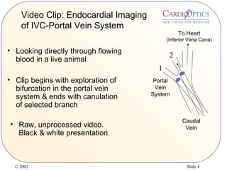 © 2002 Slide 4
• Looking directly through flowing
blood in a live animal
• Clip begins with exploration of
bifurcation in the portal vein
system & ends with canulation
of selected branch
• Raw, unprocessed video.
Black & white presentation.
Video Clip: Endocardial Imaging
of IVC-Portal Vein System
1
2
To Heart
(Inferior Vena Cava)
Portal
Vein
System
Caudal
Vein
 