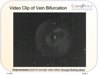 © 2002 Slide 5
Video Clip of Vein Bifurcation
Unprocessed proof of concept video taken through flowing blood.
 