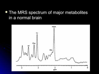  The MRS spectrum of major metabolitesThe MRS spectrum of major metabolites
in a normal brainin a normal brain
 