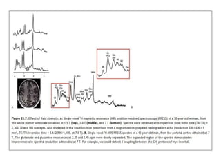 MR Spectroscopy | PPTX
