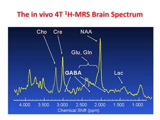 Mrs. Brain Example MR Spectroscopy | PPTX