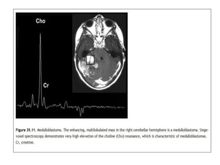 MR Spectroscopy | PPTX