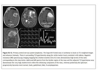 MR Spectroscopy | PPTX